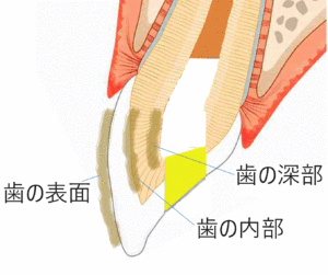 変色部位